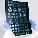 Clinical Neuroscience Meets Everyday Life: New Insights for Practice